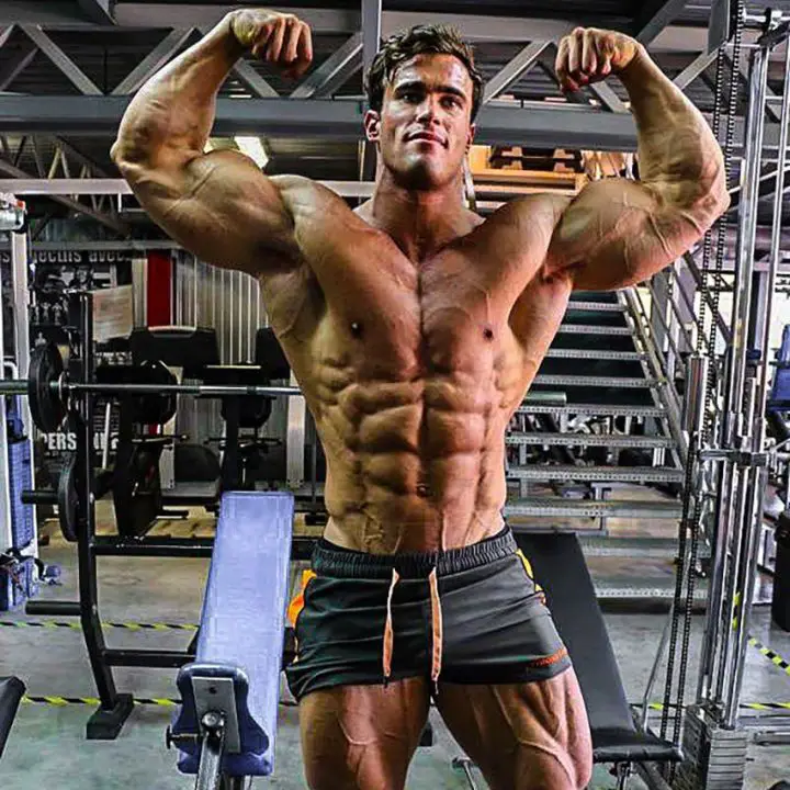 The Calum Von Moger Injury Everything You Need To Know Vekhayn